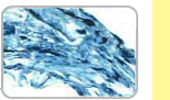 Distilled Drinking Water System